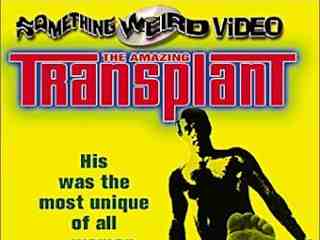 Удивительная трансплантация (1970)